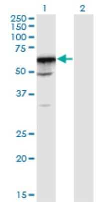 Western Blot: PRPF31 Antibody (8E1) [H00026121-M02]
