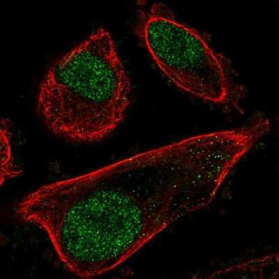 Immunocytochemistry/ Immunofluorescence: PRPF31 Antibody [NBP2-57695]