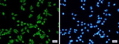 Immunocytochemistry/ Immunofluorescence: PRPF31 Antibody (S01-7F1) [NBP3-19498]