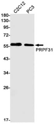 Western Blot: PRPF31 Antibody (S01-7F1) [NBP3-19498]