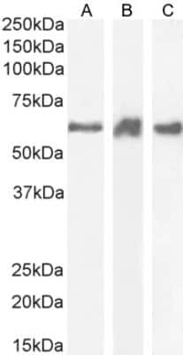 Western Blot: PRPF31 Antibody [NB100-55409]