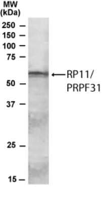 Western Blot: PRPF31 Antibody [NBP1-51909]