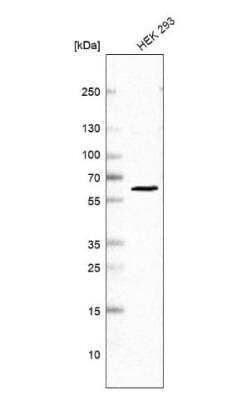 Western Blot: PRPF31 Antibody [NBP1-82510]