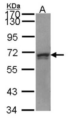 Western Blot: PRPF31 Antibody [NBP2-19963]