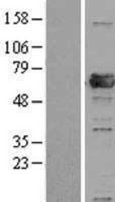 Western Blot: PRPF31 Overexpression Lysate [NBL1-14819]