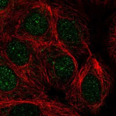 Immunocytochemistry/ Immunofluorescence: PRPF38A Antibody [NBP2-32385]