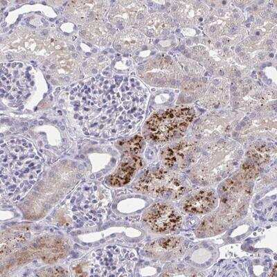 Immunohistochemistry: PRPF38A Antibody [NBP2-32385]