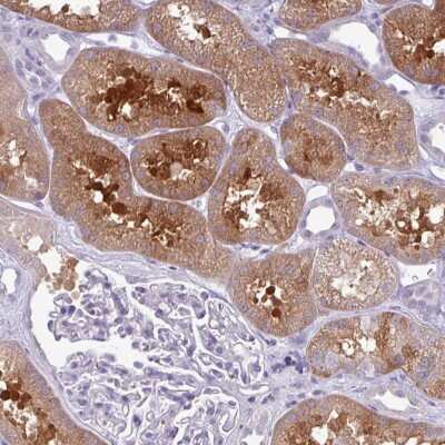 Immunohistochemistry-Paraffin: PRPF38A Antibody [NBP2-33673]