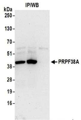 Immunoprecipitation: PRPF38A Antibody [NBP2-37697]