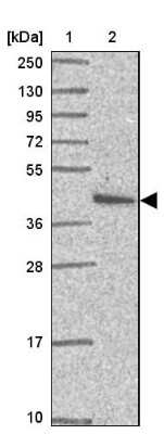 Western Blot: PRPF38A Antibody [NBP2-33673]