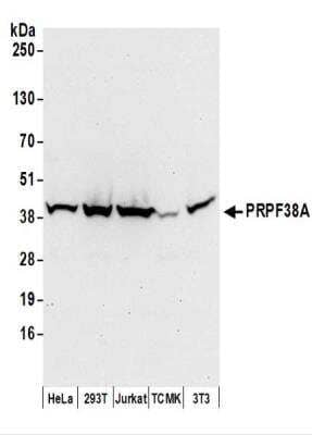 Western Blot: PRPF38A Antibody [NBP2-37697]