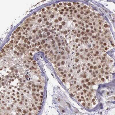 Immunohistochemistry-Paraffin: PRPF39 Antibody [NBP1-83774]