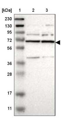 Western Blot: PRPF39 Antibody [NBP1-83774]