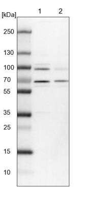 Western Blot: PRPF39 Antibody [NBP1-83774]