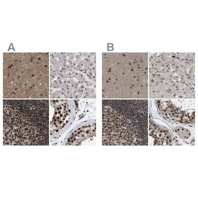 Immunohistochemistry-Paraffin: PRPF4 Antibody [NBP1-83218]