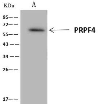 PRPF4 Antibody (NBP312635) BioTechne