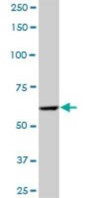 Western Blot: PRPF4 Antibody [H00009128-B01P]