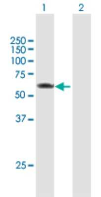 Western Blot: PRPF4 Antibody [H00009128-B01P]
