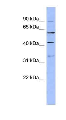 Western Blot: PRPF4 Antibody [NBP1-57150]