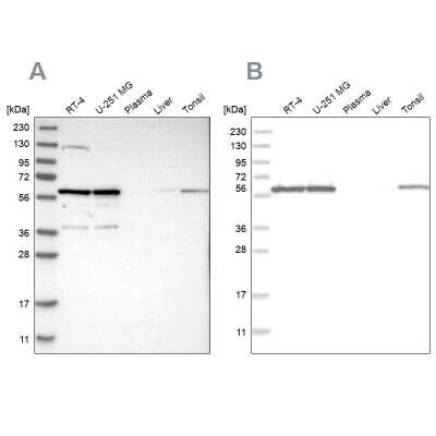 Western Blot: PRPF4 Antibody [NBP1-83217]