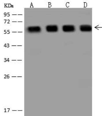 Western Blot: PRPF4 Antibody [NBP3-12635]