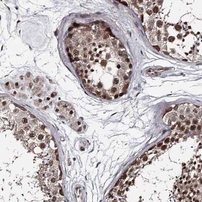 Immunohistochemistry-Paraffin: PRPF40B Antibody [NBP1-93679]