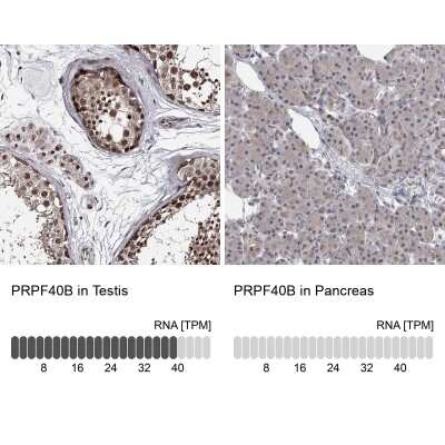 Immunohistochemistry-Paraffin: PRPF40B Antibody [NBP1-93679]