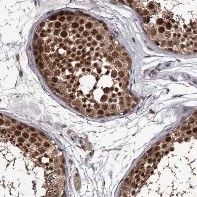 Immunohistochemistry-Paraffin: PRPF40B Antibody [NBP1-93680]
