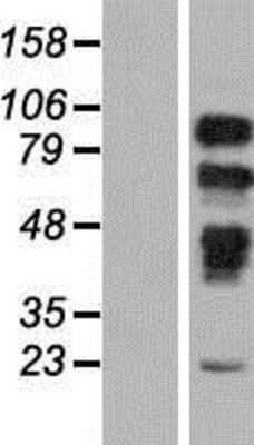 Western Blot: PRPF40B Overexpression Lysate [NBP2-08588]