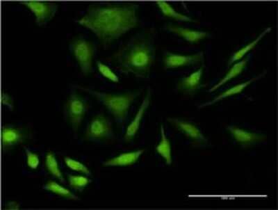 Immunocytochemistry/ Immunofluorescence: PRPF4B Antibody (3E10) [H00008899-M01]