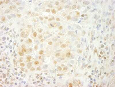 Immunohistochemistry-Paraffin: PRPF4B Antibody [NB100-86997]