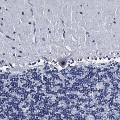 Immunohistochemistry-Paraffin: PRPF4B Antibody [NBP1-82999]