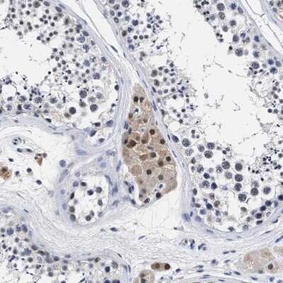 Immunohistochemistry-Paraffin: PRPF4B Antibody [NBP1-82999]