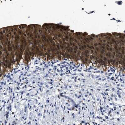 Immunohistochemistry-Paraffin: PRPF4B Antibody [NBP1-82999]