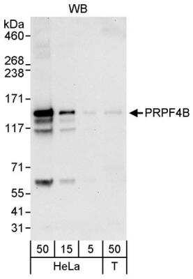 Western Blot: PRPF4B Antibody [NB100-86997]