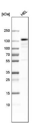 Western Blot: PRPF4B Antibody [NBP1-82999]