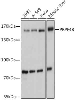 Western Blot: PRPF4B AntibodyAzide and BSA Free [NBP2-93540]