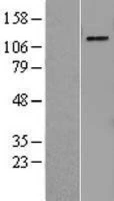 Western Blot: PRPF4B Overexpression Lysate [NBL1-14823]