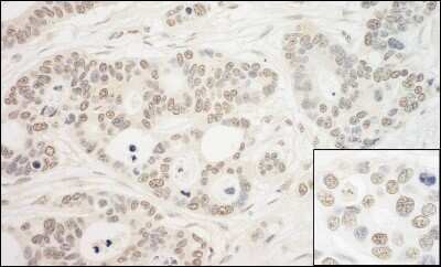 Immunohistochemistry: PRPF6 Antibody [NBP1-46212]