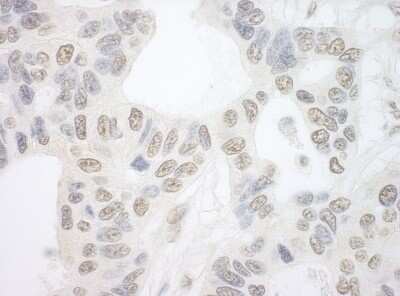 Immunohistochemistry: PRPF6 Antibody [NBP1-46213]