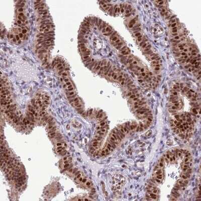 Immunohistochemistry-Paraffin: PRPF6 Antibody [NBP1-92298]