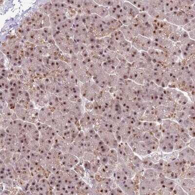Immunohistochemistry-Paraffin: PRPF6 Antibody [NBP1-92298]