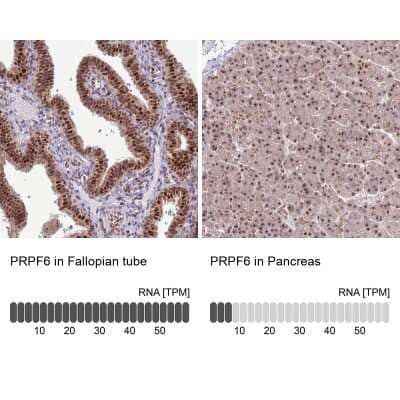 Immunohistochemistry-Paraffin: PRPF6 Antibody [NBP1-92298]