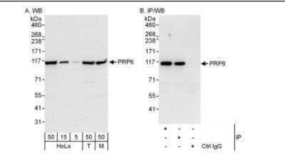 Western Blot: PRPF6 Antibody [NBP1-46212]