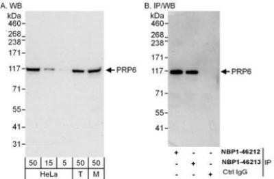 Western Blot: PRPF6 Antibody [NBP1-46213]