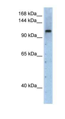 Western Blot: PRPF6 Antibody [NBP1-57544]