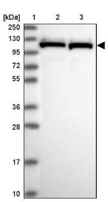 Western Blot: PRPF6 Antibody [NBP1-92298]