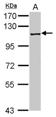 Western Blot: PRPF6 Antibody [NBP2-19965]