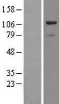 Western Blot: PRPF6 Overexpression Lysate [NBL1-14824]