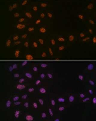 Immunocytochemistry/ Immunofluorescence: PRPF8 Antibody (4I1Q8) [NBP3-16440]